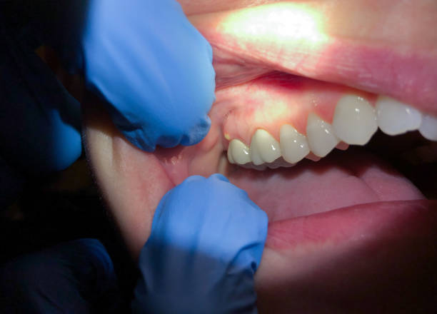 Best Cracked Tooth Emergency Dentist  in Gore, OK