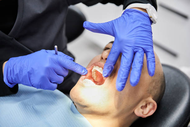 Best Chipped Tooth Repair Near Me  in Gore, OK